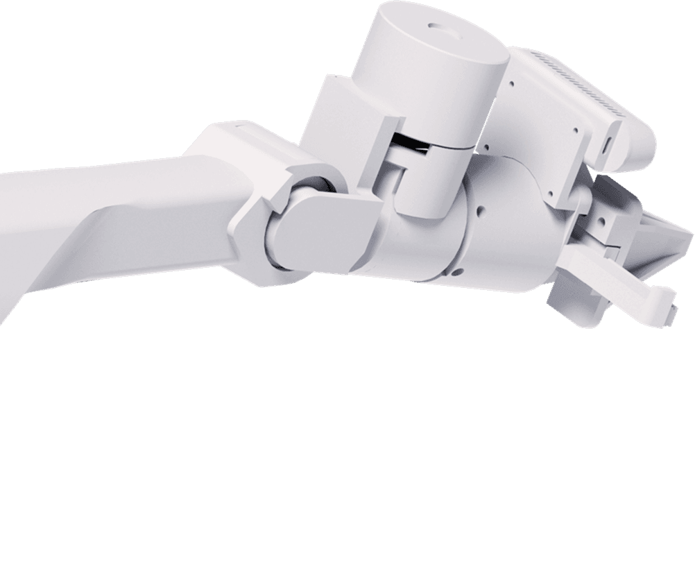 Arm